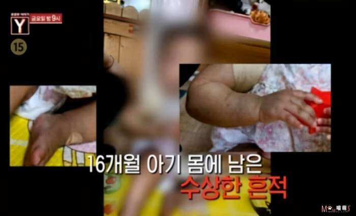 生而为人枉为人，韩国女童郑仁遭养父母虐待致死